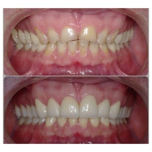 Фото от владельца Вита-Дент, стоматология
