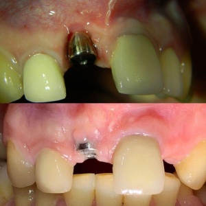 Фото от владельца АнтАлекс, зуботехническая лаборатория