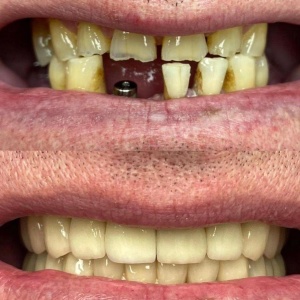 Фото от владельца Dental Design, зуботехническая лаборатория