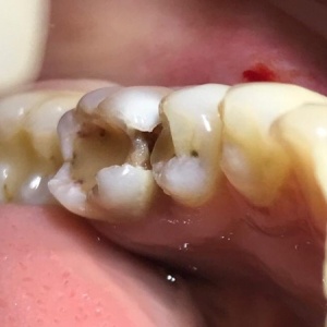 Фото от владельца Стомус Плюс, зуботехническая лаборатория