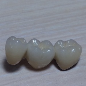 Фото от владельца New-vita, компания по ремонту зубных протезов